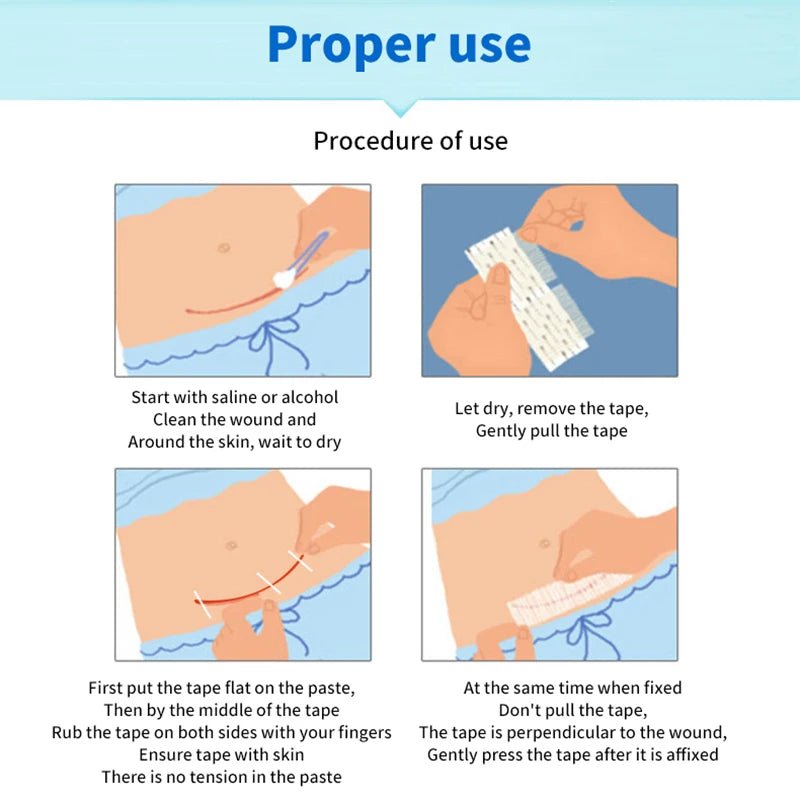 5 Strips Wound Skin Closure Strips Postpartum Wound Repair Cosmetic Surgery Strip Adhesive Medical Suture Free Surgical Tape - Cozy & Co. Market