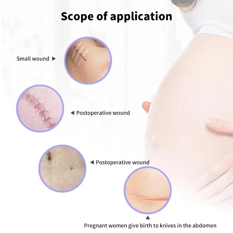 5 Strips Wound Skin Closure Strips Postpartum Wound Repair Cosmetic Surgery Strip Adhesive Medical Suture Free Surgical Tape - Cozy & Co. Market