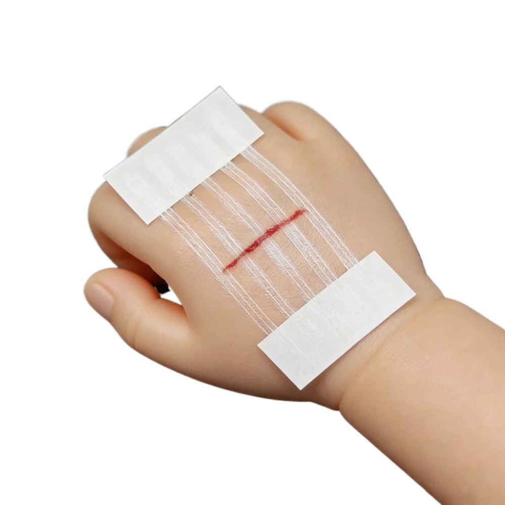 5 Strips Wound Skin Closure Strips Postpartum Wound Repair Cosmetic Surgery Strip Adhesive Medical Suture Free Surgical Tape - Cozy & Co. Market