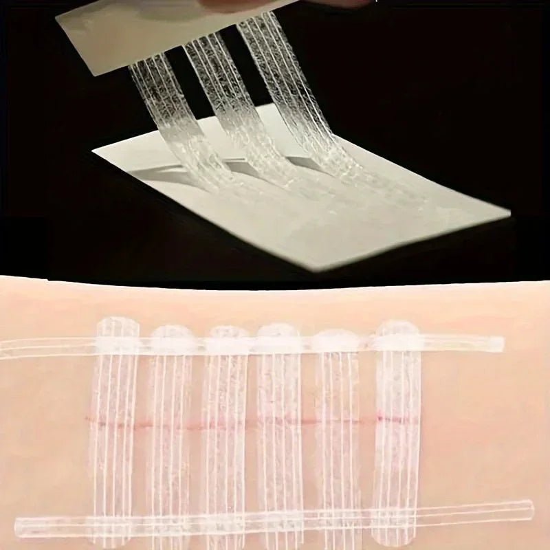 5 Strips Wound Skin Closure Strips Postpartum Wound Repair Cosmetic Surgery Strip Adhesive Medical Suture Free Surgical Tape - Cozy & Co. Market