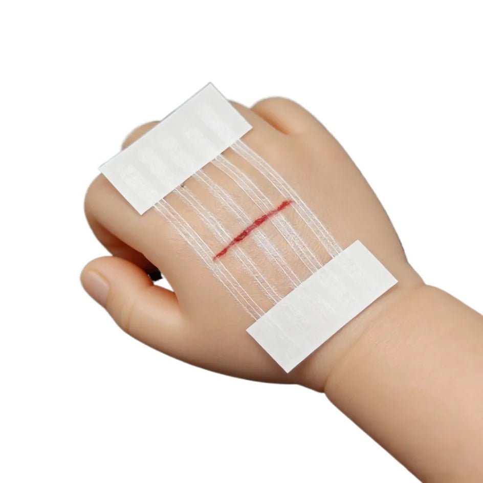 5 Strips Wound Skin Closure Strips Postpartum Wound Repair Cosmetic Surgery Strip Adhesive Medical Suture Free Surgical Tape - Cozy & Co. Market