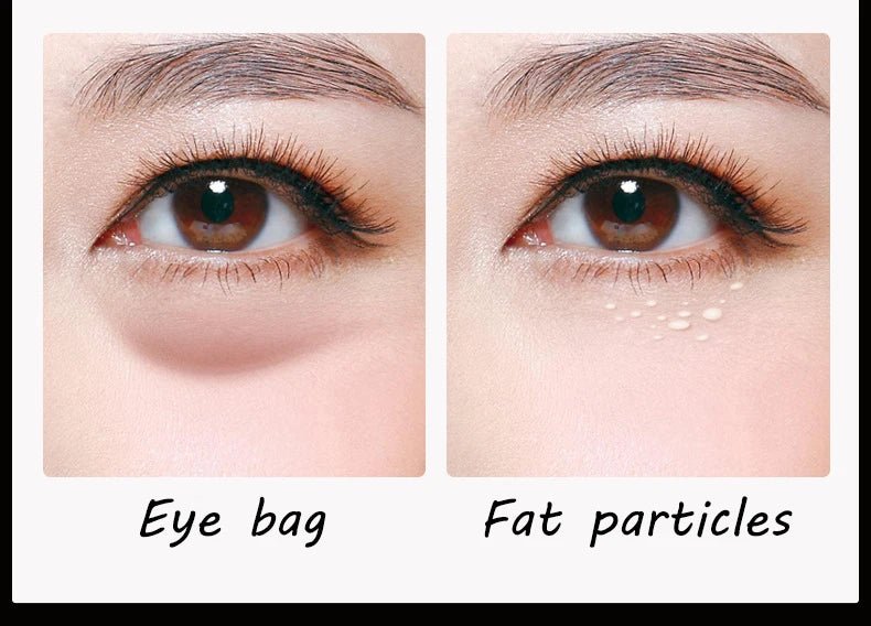 5pcs Gold Nourish Mung Bean Eye Mask Anti Dark Circles Masks Eye Patches Desalination Eye Bags Korean Skin Care Products - Cozy & Co. Market