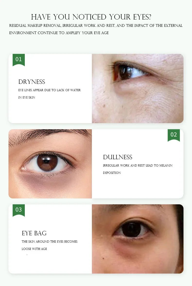 5pcs Gold Nourish Mung Bean Eye Mask Anti Dark Circles Masks Eye Patches Desalination Eye Bags Korean Skin Care Products - Cozy & Co. Market