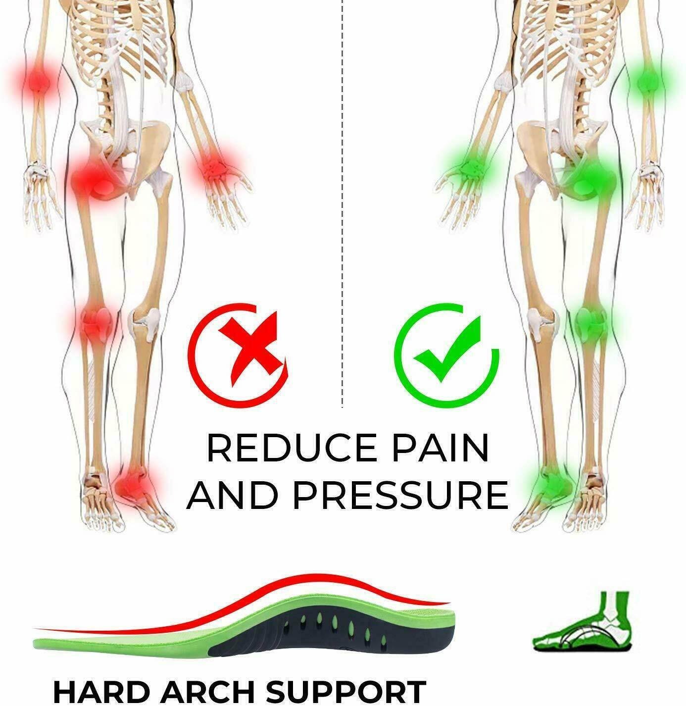 Orthotic Shoe Insoles Inserts Flat Feet High Arch Support For Plantar Fasciitis - Cozy & Co. Market