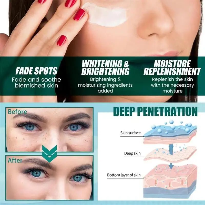 Powerful Spot-removing Whitening Freckles Cream Remove Melasma Dark Spots Fade Pigmentation Acne Moisturizing Brighten Skin Care - Cozy & Co. Market