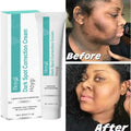 Powerful Spot-removing Whitening Freckles Cream Remove Melasma Dark Spots Fade Pigmentation Acne Moisturizing Brighten Skin Care - Cozy & Co. Market