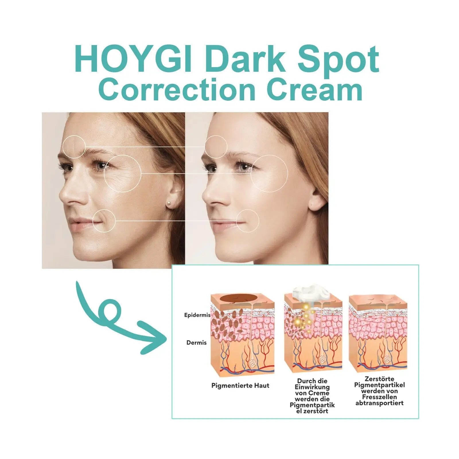 Powerful Spot-removing Whitening Freckles Cream Remove Melasma Dark Spots Fade Pigmentation Acne Moisturizing Brighten Skin Care - Cozy & Co. Market