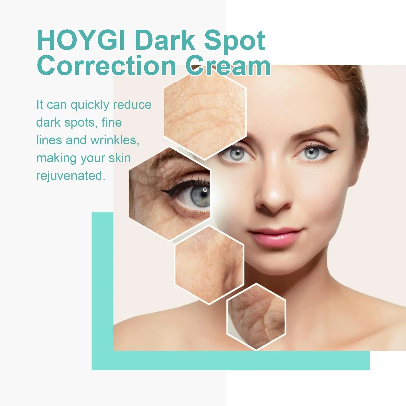 Powerful Spot-removing Whitening Freckles Cream Remove Melasma Dark Spots Fade Pigmentation Acne Moisturizing Brighten Skin Care - Cozy & Co. Market