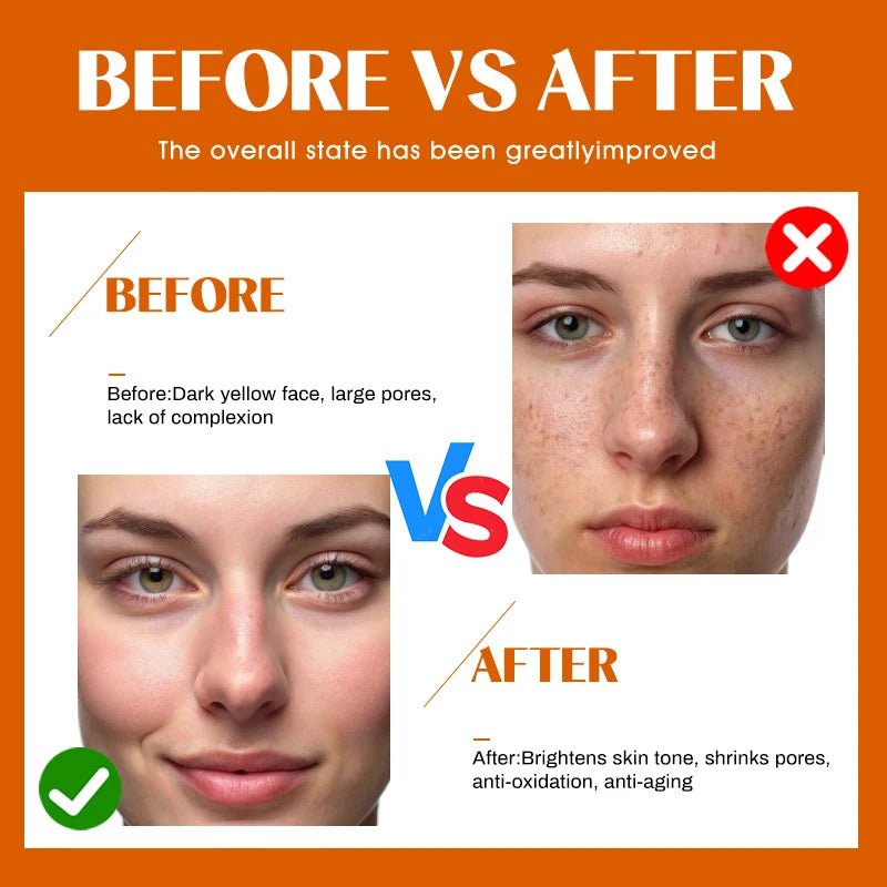 Vitamin C Hyaluronic acid Six Peptide Snail Mucin Facial Serum for Skin Care Apply Dr.Pen ACNE Solution Moisturizing 10Vials - Cozy & Co. Market